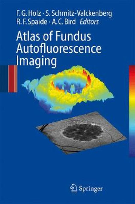 Atlas of Fundus Autofluorescence Imaging by Frank G. Holz