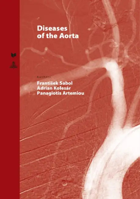 Diseases of the Aorta by Veda, Frantisek Sabol, Adrian Kolesar