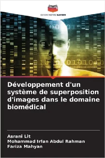 Développement d'un système de superposition d'images dans le domaine biomédical by Lit, Asrani