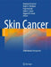 Skin Cancer - A World-Wide Perspective by Reinhard Dummer, Mark R. Pittelkow, Keiji Iwatsuki