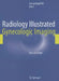 Radiology Illustrated: Gynecologic Imaging by Seung Hyup Kim