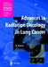 Advances in Radiation Oncology in Lung Cancer by Branislav Jeremic