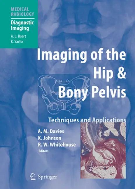 Imaging of the Hip & Bony Pelvis: Techniques and Applications by A. Mark Davies