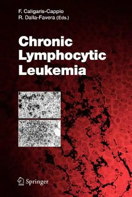 Chronic Lymphocytic Leukemia by Federico Caligaris-Cappio