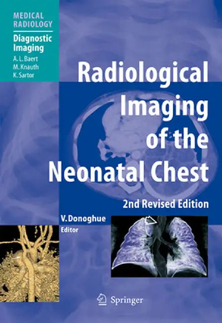 Radiological Imaging of the Neonatal Chest by Veronica B. Donoghue