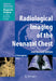 Radiological Imaging of the Neonatal Chest by Veronica B. Donoghue