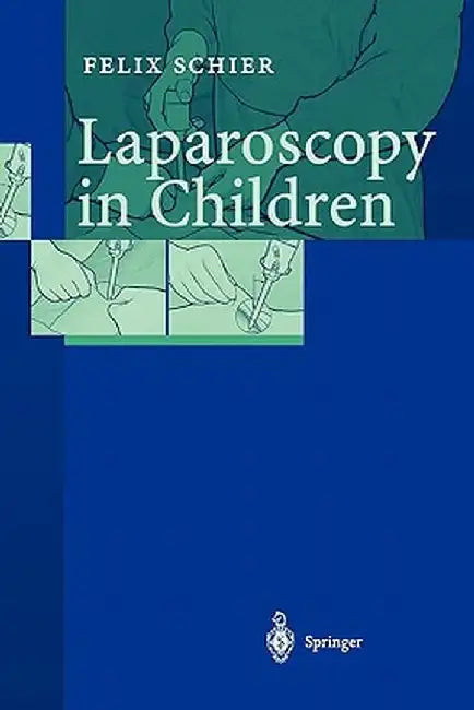 Laparoscopy in Children by Felix Schier