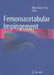Femoroacetabular Impingement by Óliver Marín-Peña