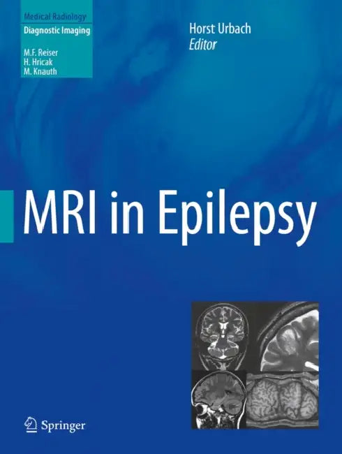 MRI in Epilepsy by Horst Urbach