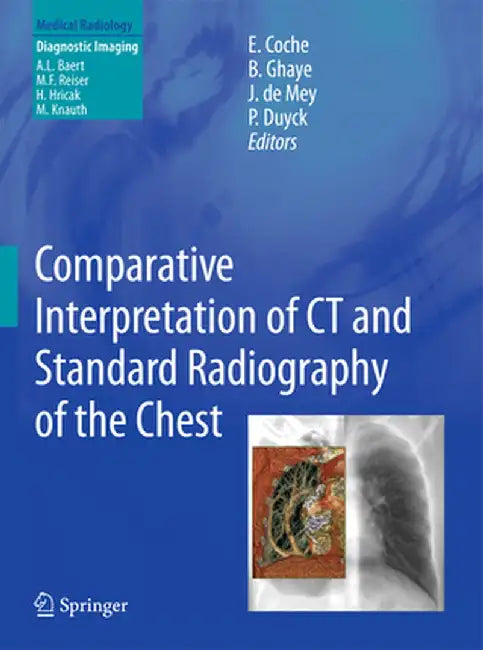 Comparative Interpretation of CT and Standard Radiography of the Chest by Emmanuel E. Coche