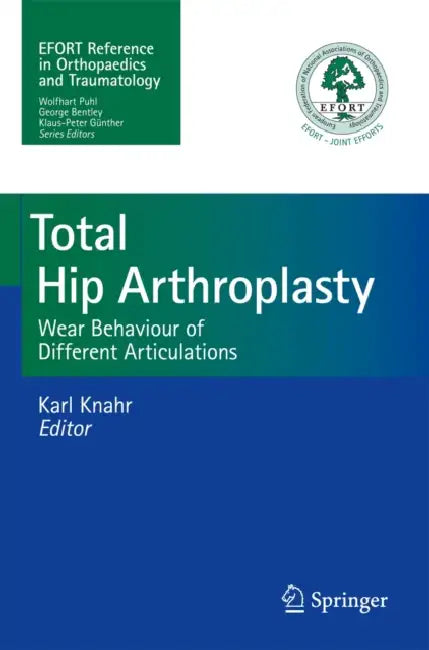 Total Hip Arthroplasty: Wear Behaviour of Different Articulations by Karl Knahr