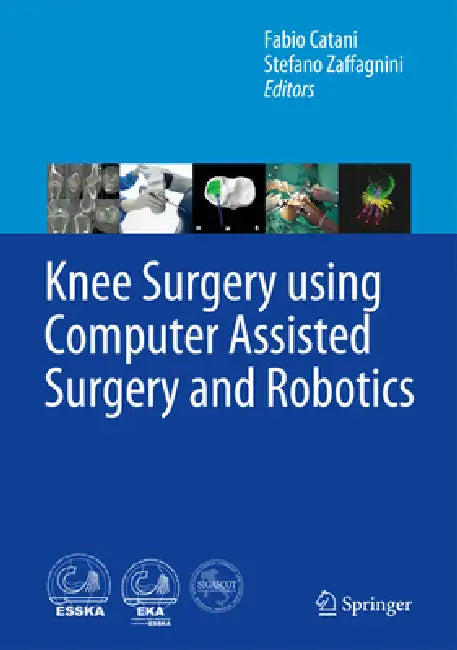 Knee Surgery Using Computer Assisted Surgery and Robotics by Fabio Catani, Stefano Zaffagnini