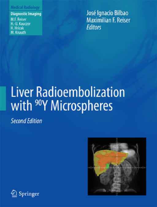 Liver Radioembolization with 90y Microspheres by José Ignacio Bilbao, Maximilian F. Reiser