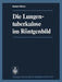 Die Lungentuberkulose Im Röntgenbild by H. Blaha