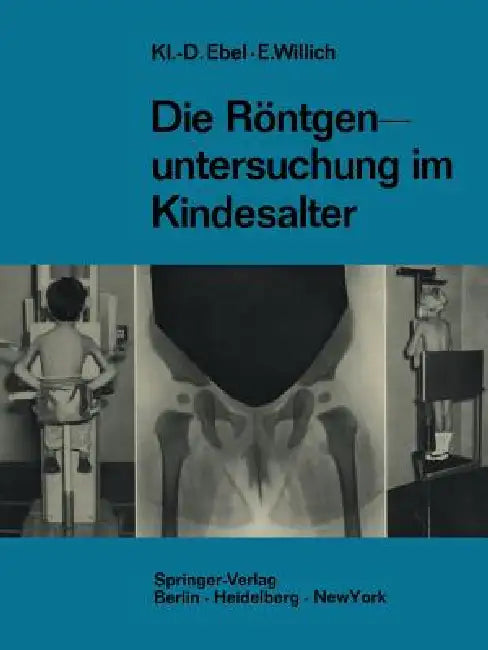 Die Röntgenuntersuchung Im Kindesalter: Technik Und Indikation by Klaus-Dietrich Ebel, Eberhard Willich