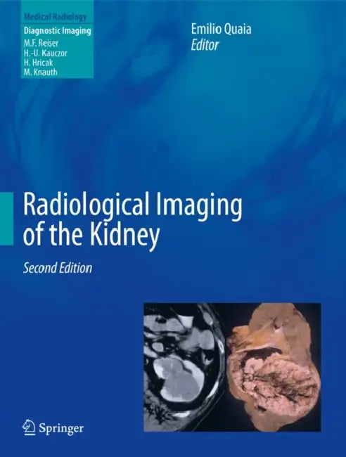 Radiological Imaging of the Kidney by Emilio Quaia