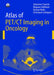 Atlas of Pet/CT Imaging in Oncology by Johannes Czernin
