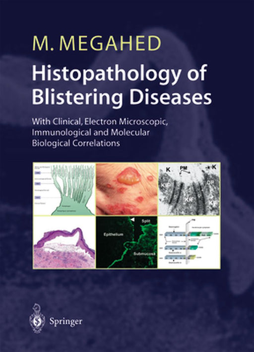 Histopathology of Blistering Diseases: With Clinical, Electron Microscopic, Immunological and Molecular Biological Correlations Textbook and Atlas by Mosaad Megahed