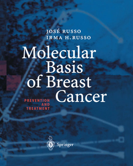 Molecular Basis of Breast Cancer: Prevention and Treatment by Jose Russo