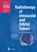 Radiotherapy of Intraocular and Orbital Tumors by R. H. Sagerman