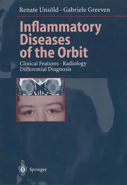 Inflammatory Diseases of the Orbit: Clinical Features - Radiology Differential Diagnosis by Renate Unsöld