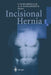 Incisional Hernia by Volker Schumpelick