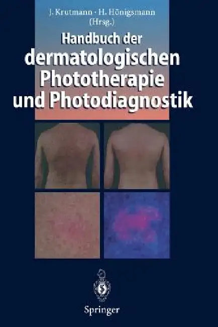 Handbuch Der Dermatologischen Phototherapie Und Photodiagnostik by Jean Krutmann, Herbert Hönigsmann