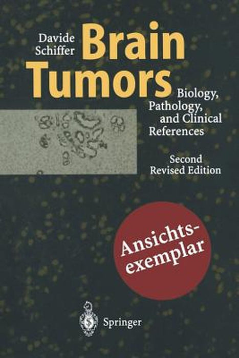 Brain Tumors: Biology, Pathology and Clinical References by M. T. Giordana