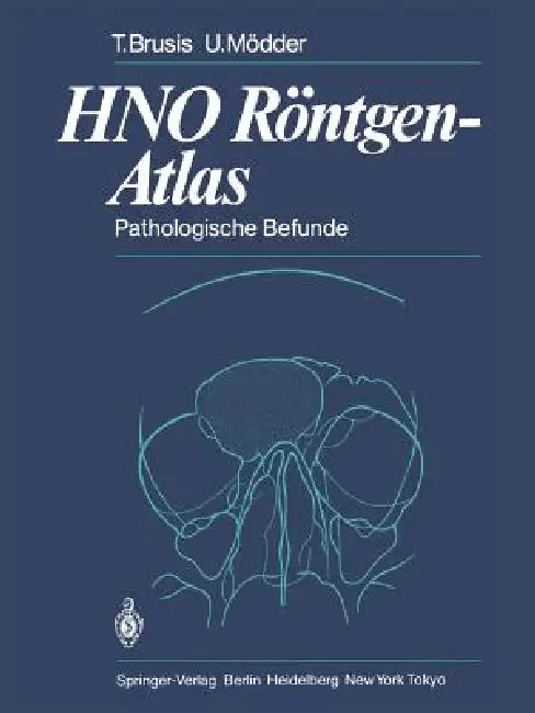 Hno Röntgen-Atlas: Pathologische Befunde by Tilman Brusis, G. Friedmann, Ulrich Mödder