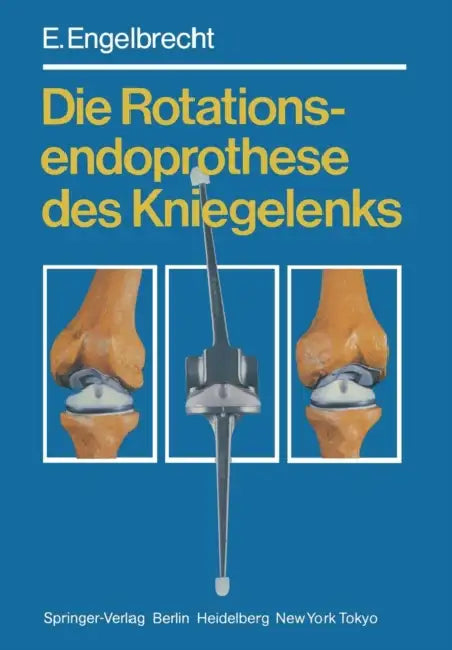Die Rotationsendoprothese Des Kniegelenks by E. Engelbrecht, H. W. Buchholz