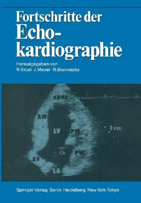 Fortschritte Der Echokardiographie by Raimund Erbel, Jürgen Meyer, Rüdiger Brennecke