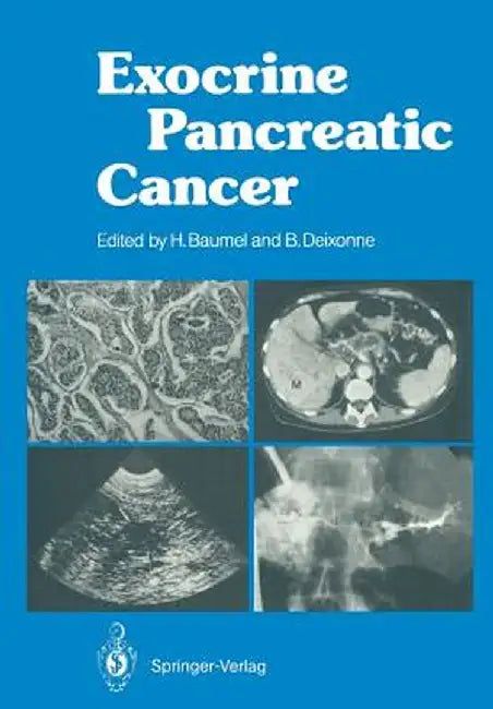 Exocrine Pancreatic Cancer by Hughes Baumel
