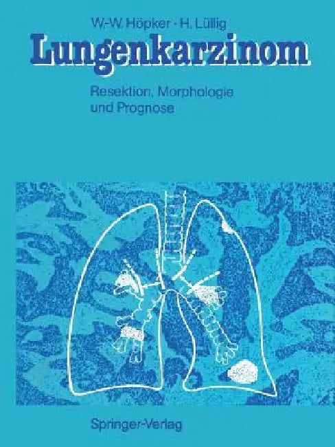 Lungenkarzinom: Resektion, Morphologie Und Prognose by Wilhelm-Wolfgang Höpker, W. Doerr, Helmut Lüllig