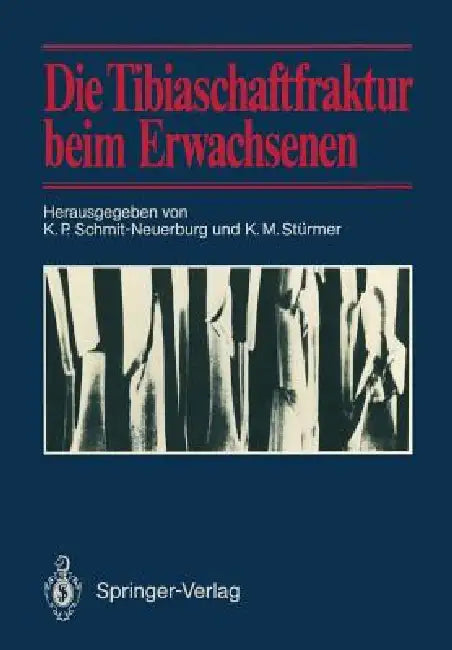 Die Tibiaschaftfraktur Beim Erwachsenen: Symposium Anläßlich Des 10jährigen Bestehens Der Abteilung Für Unfallchirurgie Am Klinikum Essen, 1./2. Febru by K. P. Schmit-Neuerburg, K. M. Stürmer