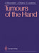 Tumours of the Hand by Julien Glicenstein