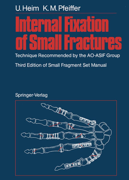 Internal Fixation of Small Fractures: Technique Recommended by the Ao-Asif Group by J. Brennwald