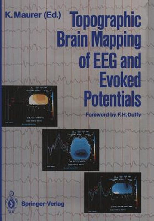 Topographic Brain Mapping of Eeg and Evoked Potentials by Konrad Maurer