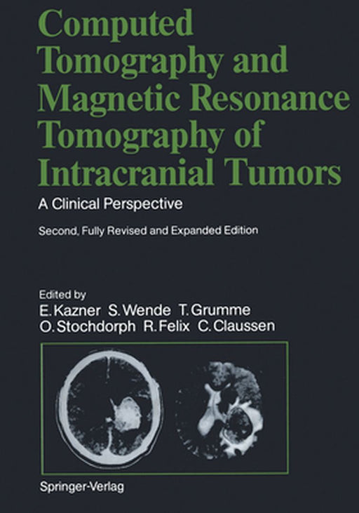 Computed Tomography and Magnetic Resonance Tomography of Intracranial Tumors: A Clinical Perspective by Terry C. Telger