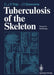 Tuberculosis of the Skeleton: Focus on Radiology by Cornelis J. P. Thijn