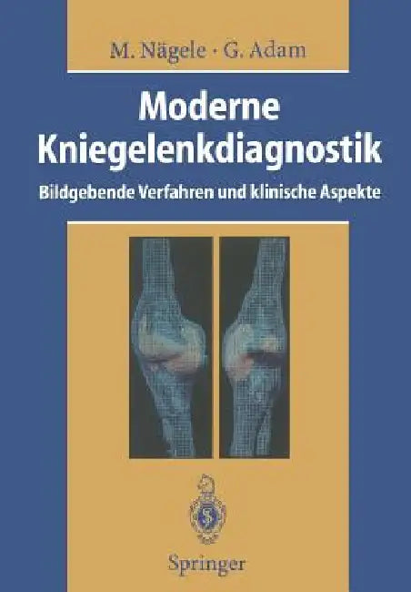 Moderne Kniegelenkdiagnostik: Bildgebende Verfahren Und Klinische Aspekte by Matthias Nägele, R. W. Günther, Gerhard Adam