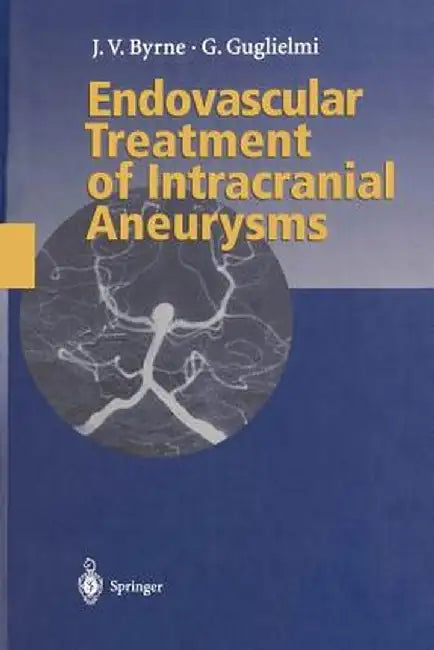 Endovascular Treatment of Intracranial Aneurysms by James Byrne