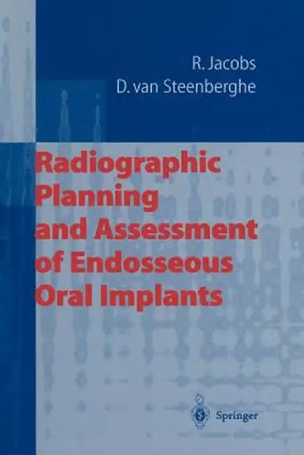 Radiographic Planning and Assessment of Endosseous Oral Implants by Reinhilde Jacobs