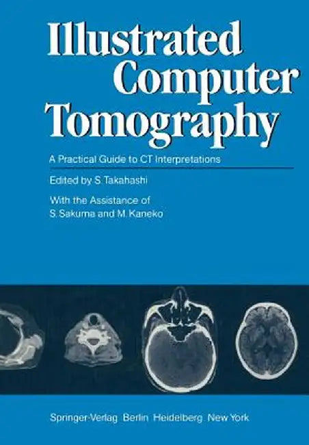 Illustrated Computer Tomography: A Practical Guide to CT Interpretations by S. Takahashi