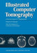 Illustrated Computer Tomography: A Practical Guide to CT Interpretations by S. Takahashi
