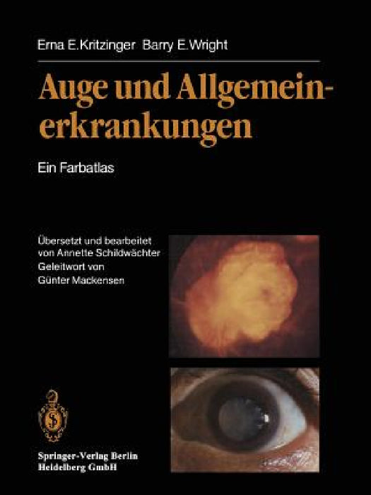 Auge Und Allgemeinerkrankungen: Ein Farbatlas by Erna E. Kritzinger, G. Mackensen, Annette Schildwächter