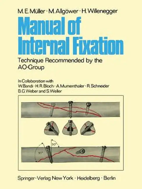 Manual of Internal Fixation: Technique Recommended by the Ao-Group Swiss Association for the Study of Internal Fixation: Asif by W. Bandi