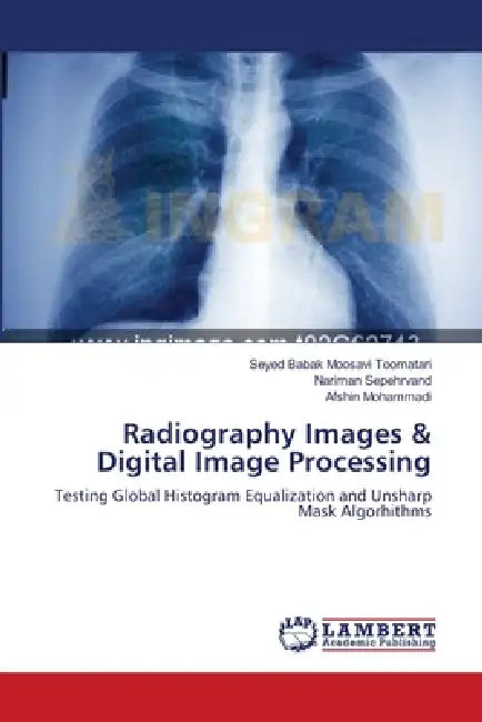 Radiography Images & Digital Image Processing by Seyed Babak Moosavi Toomatari, Nariman Sepehrvand, Afshin Mohammadi