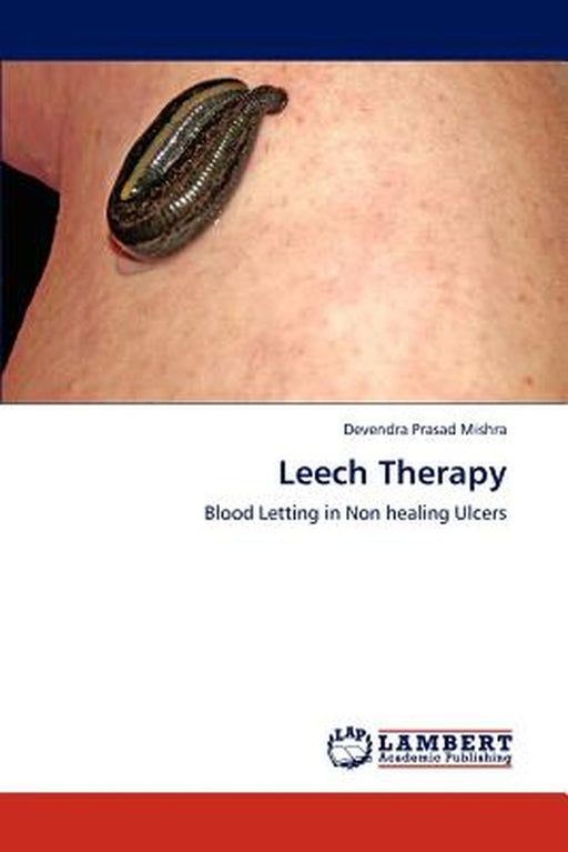 Leech Therapy by Mishra Devendra Prasad