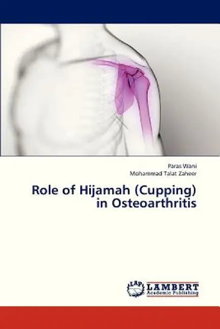 Role Of Hijamah (Cupping) In Osteoarthritis by Wani Paras