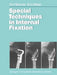 Special Techniques in Internal Fixation by C. F. Brunner